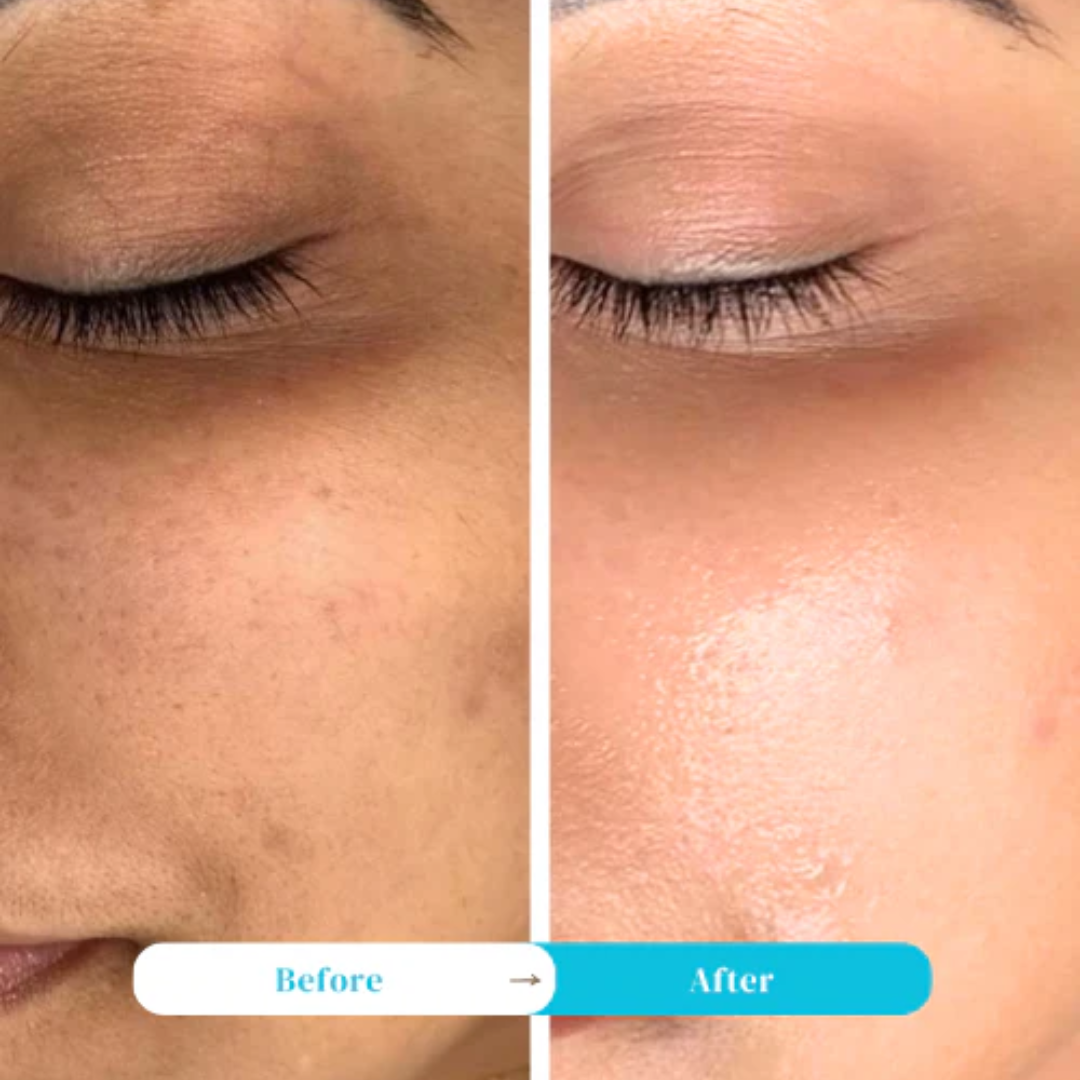 Madeca Cream Time Reverse | Blemish, Wrinkle & Dark Spot Repair | Imported from Korea