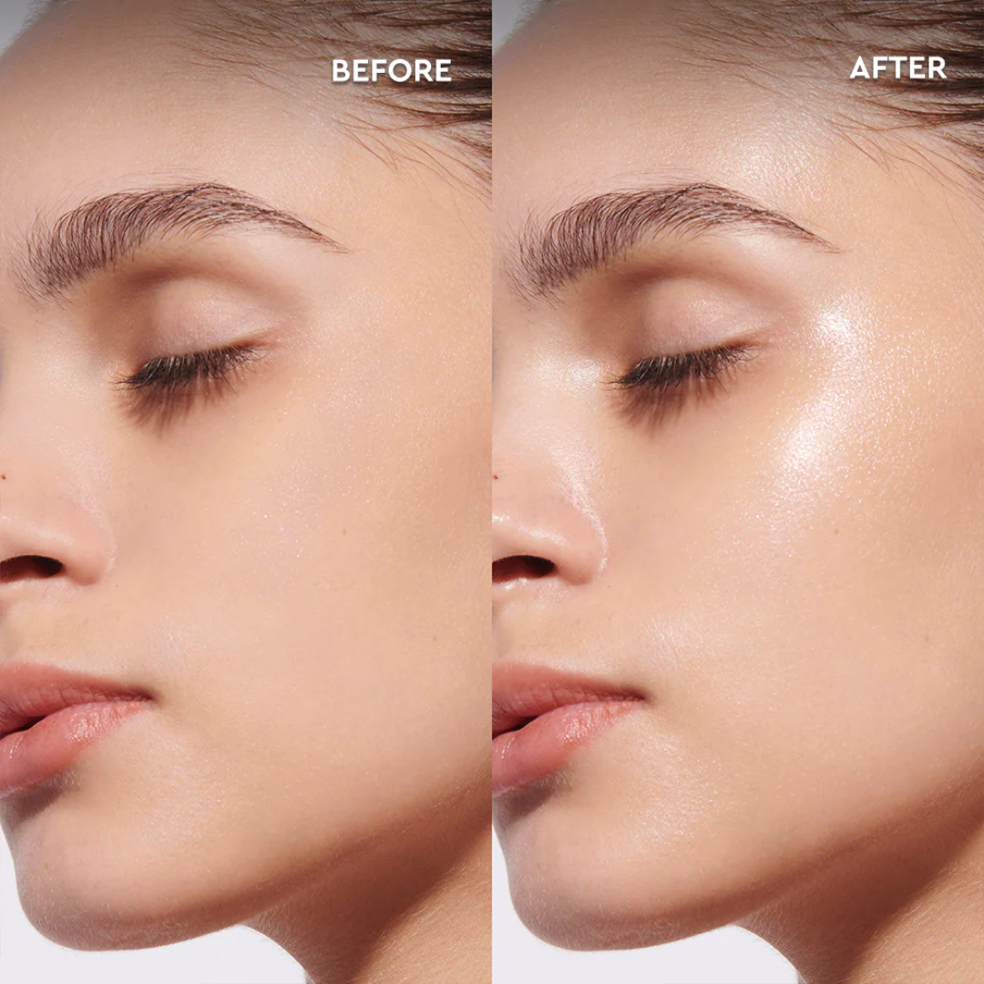 Glow Boost & Anti-Pigmentation Lotion | Niacinamide + Vitamin E + Hyaluronic Acid | Brightening, Hydrating & Dark Spot Corrector