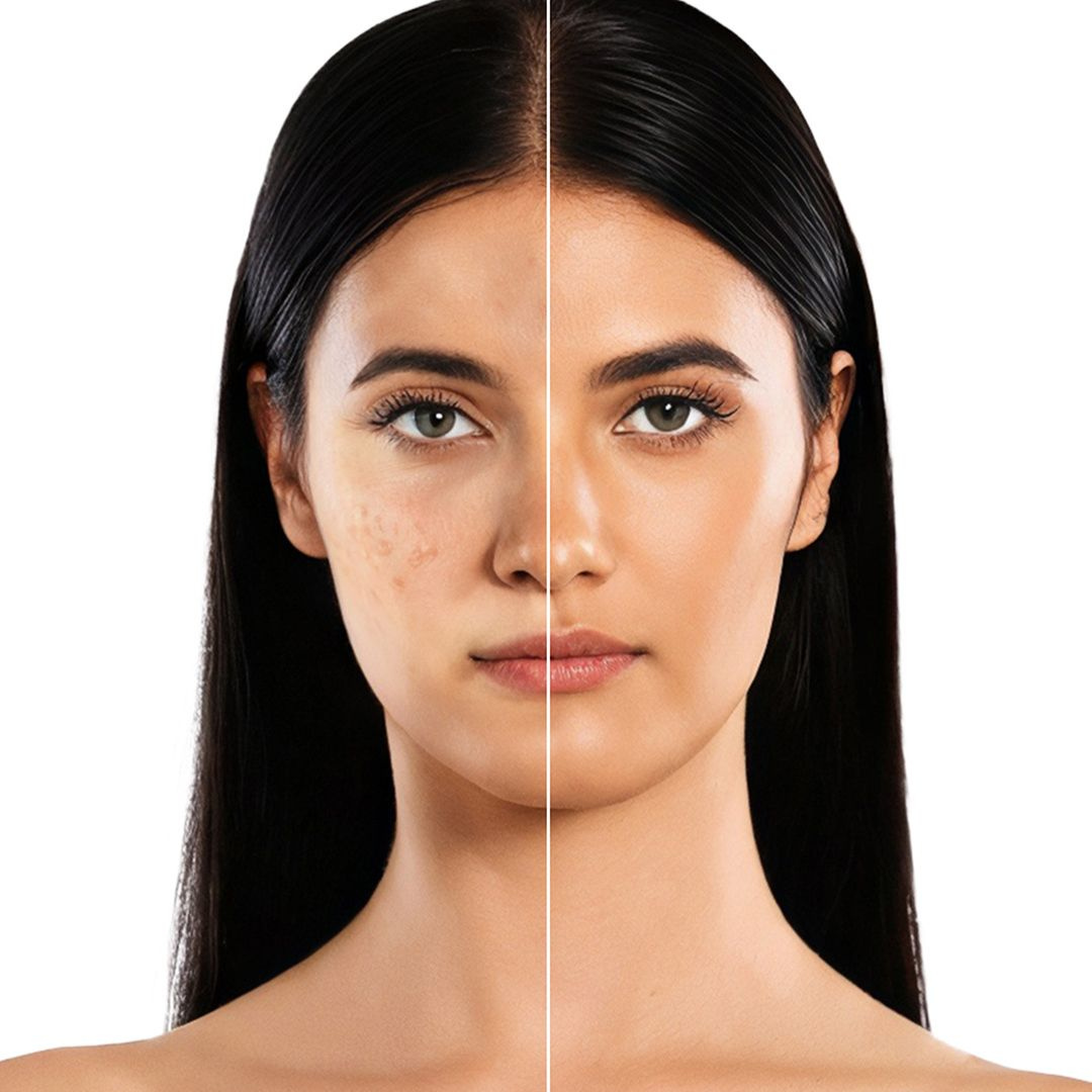 Glow Boost & Anti-Pigmentation Lotion | Niacinamide + Vitamin E + Hyaluronic Acid | Brightening, Hydrating & Dark Spot Corrector