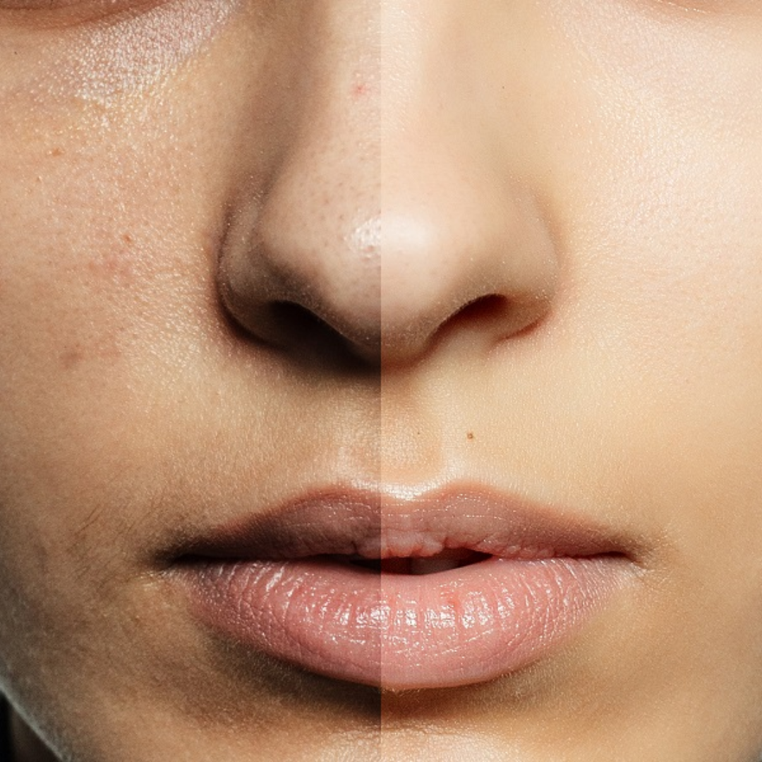 Time Reverse Madeca Cream | Anti-Aging & Skin Revitalization | Pharmaceutical-Grade TECA