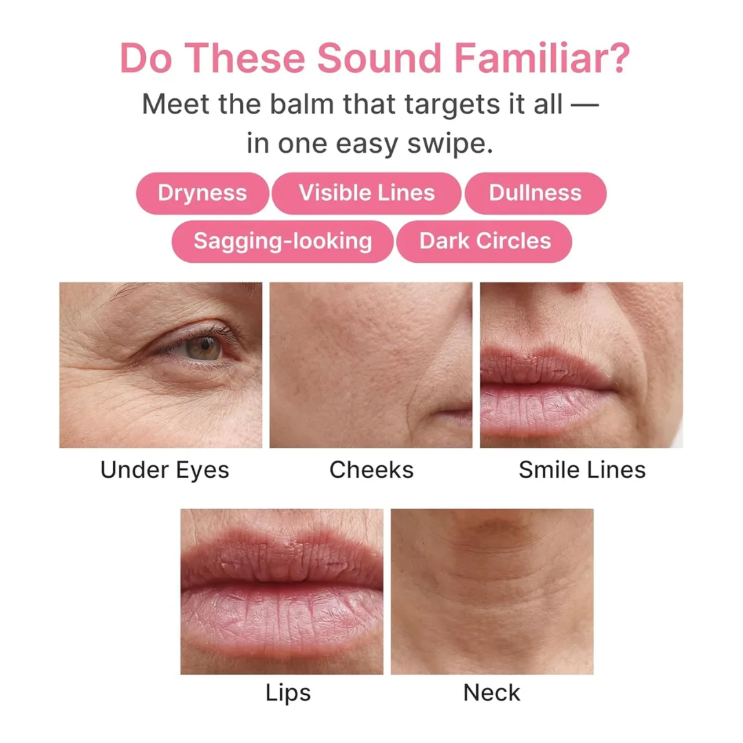 Medicube PDRN Pink Collagen Volume Multi Balm Stick – Plumps Hollow Areas, Improves Firmness & Elasticity – For Under-Eye Hollowness, Cheek Volume Loss, Smile Lines & Fine Lines