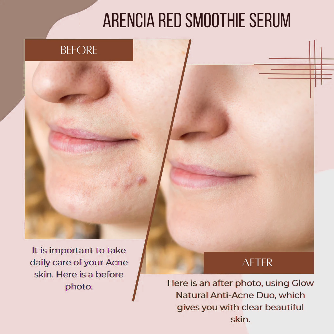 Arencia Fresh Red Glow Booster Serum - Even, Bright & Glass Skin