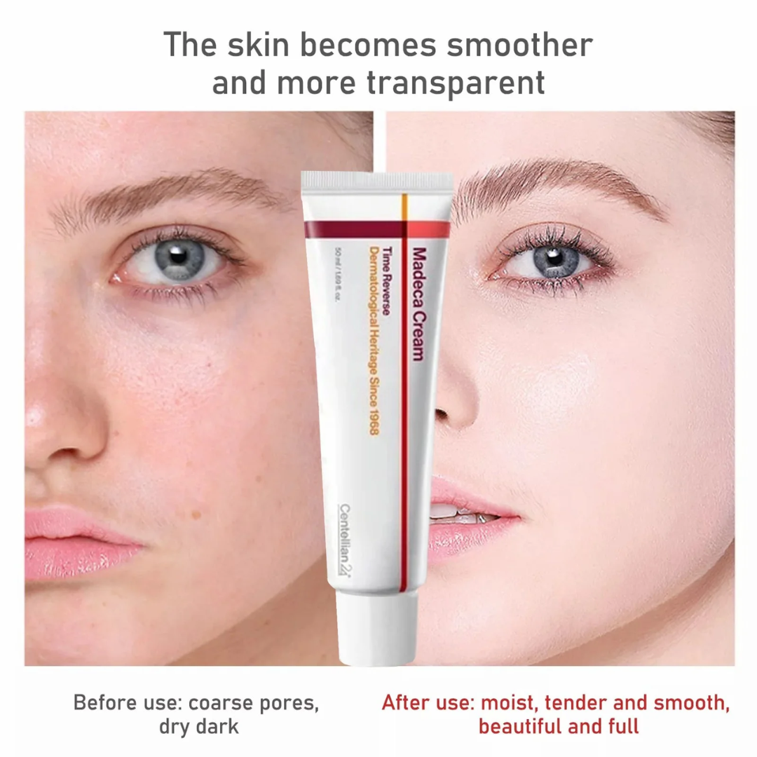 Madeca Cream Time Reverse | Blemish, Wrinkle & Dark Spot Repair | Imported from Korea