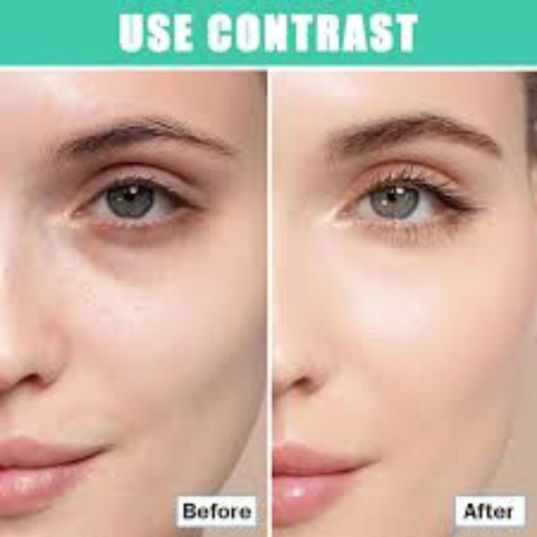 Glow Boost & Anti-Pigmentation Lotion | Niacinamide + Vitamin E + Hyaluronic Acid | Brightening, Hydrating & Dark Spot Corrector