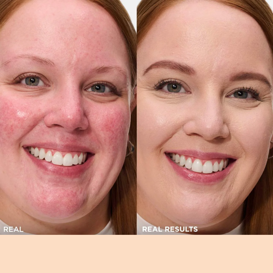 All in one High Coverage Tender Cream | Conceal, Cover & Hydration | Light weight & long-lasting | For all Skin Types