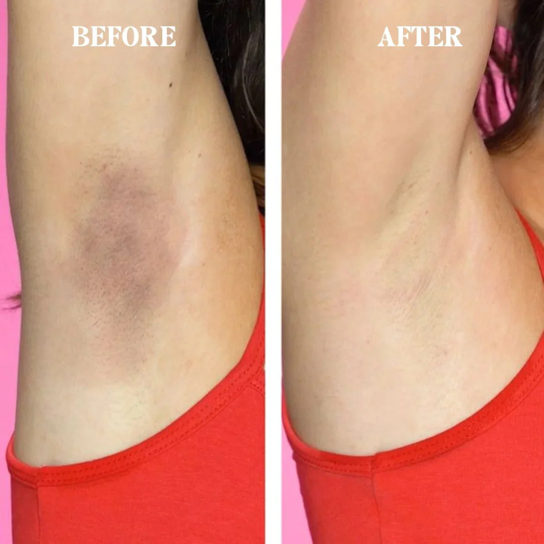 RAY BY RAFIA Underarm Serum – Time to Shine – Brightens Dark Underarms, Reduces Odour, Smooths Bumpy Skin – With Glycolic Acid – For Dark Neck & Strawberry Legs Too