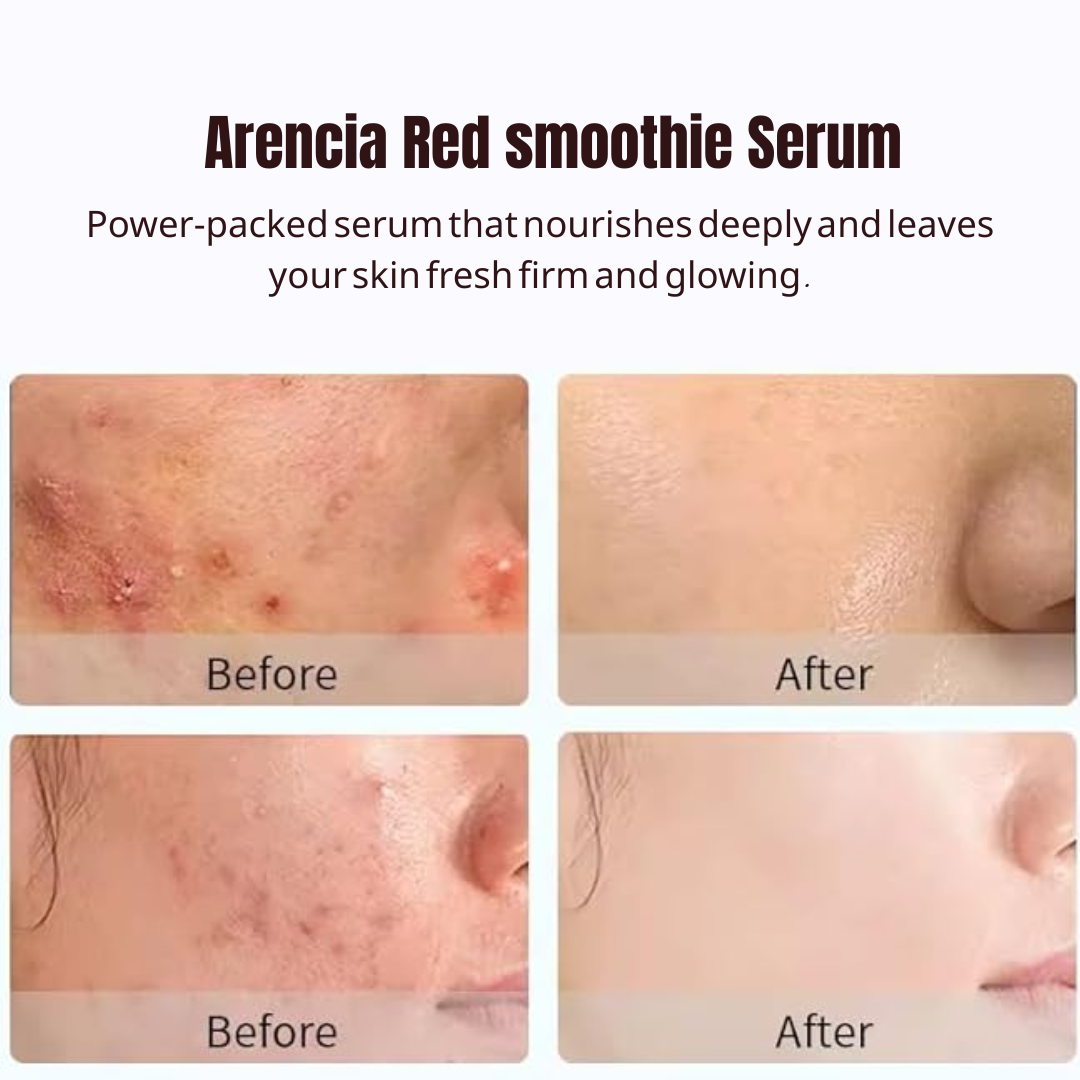 Arencia Fresh Red Glow Booster Serum - Even, Bright & Glass Skin