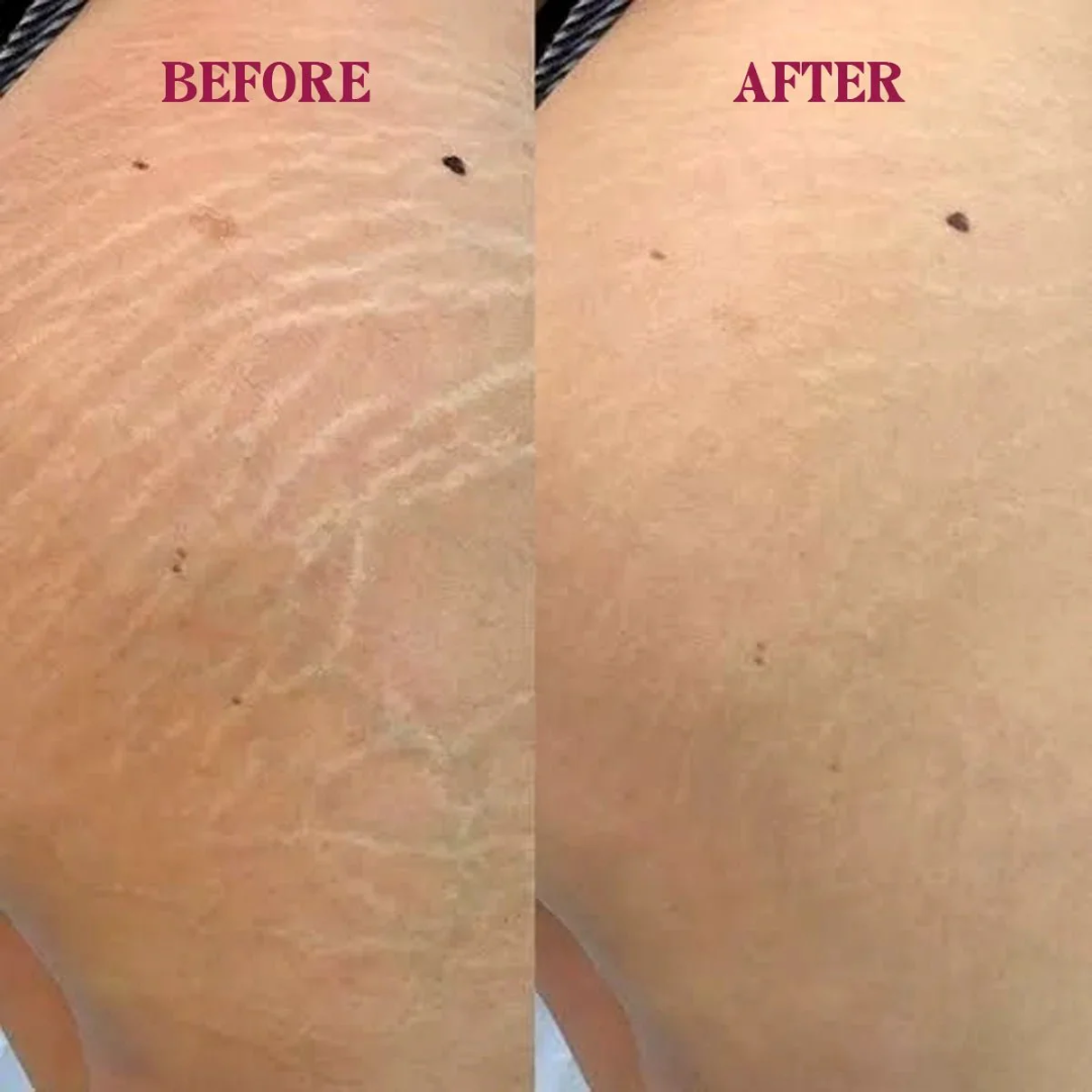 RAY BY RAFIA Underarm Serum – Time to Shine – Brightens Dark Underarms, Reduces Odour, Smooths Bumpy Skin – With Glycolic Acid – For Dark Neck & Strawberry Legs Too