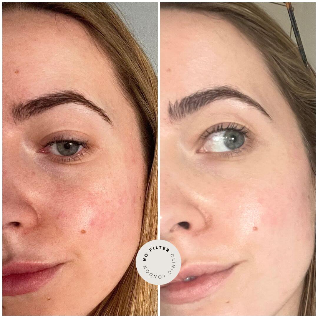 Madeca Cream Time Reverse | Blemish, Wrinkle & Dark Spot Repair | Imported from Korea