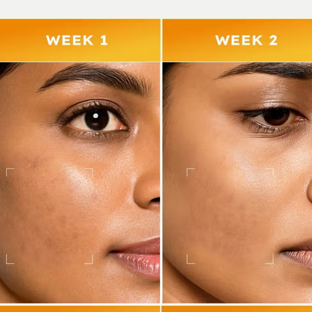 HYPHEN Double Shot Radiance-Lift Serum | Dual Phase Brightening + Collagen Booster | Reduces Fine Lines & Wrinkles