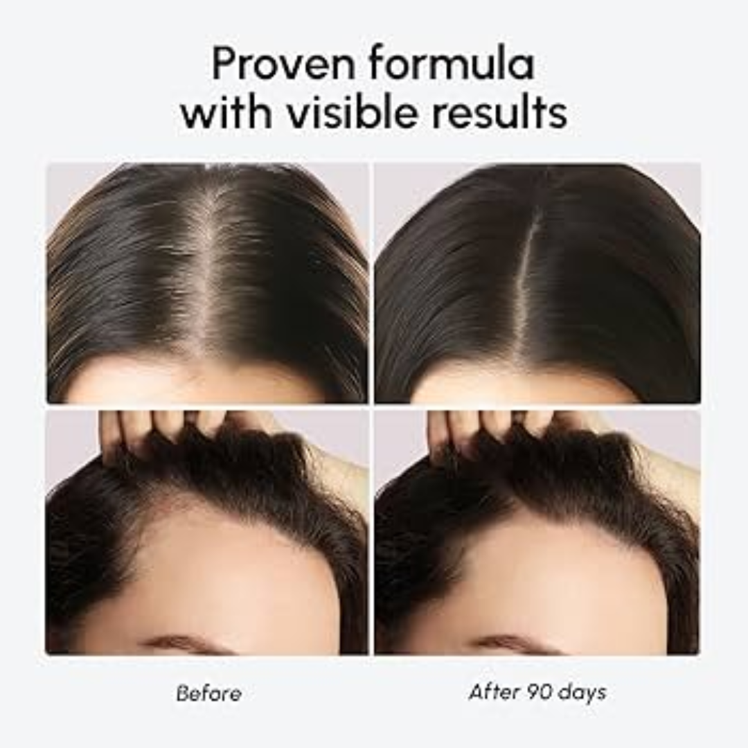 The Muse Labs Peptide Hair Growth Serum | Reduces Hair Fall, Boosts Density & Strengthens Roots | Multi-Peptide Formula