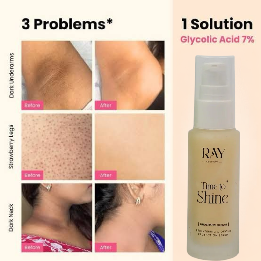 RAY BY RAFIA Underarm Serum – Time to Shine – Brightens Dark Underarms, Reduces Odour, Smooths Bumpy Skin – With Glycolic Acid – For Dark Neck & Strawberry Legs Too