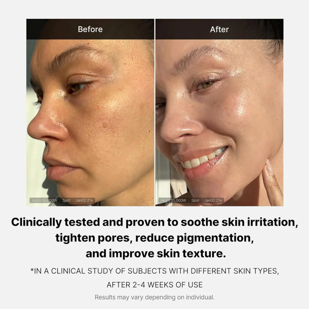 Medicube PDRN Pink Collagen Volume Multi Balm Stick – Plumps Hollow Areas, Improves Firmness & Elasticity – For Under-Eye Hollowness, Cheek Volume Loss, Smile Lines & Fine Lines