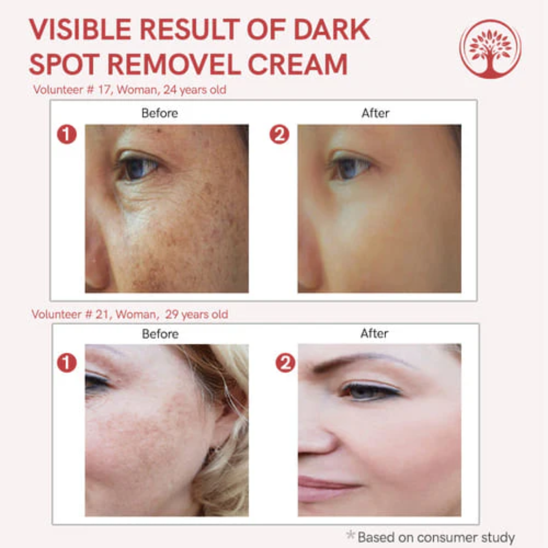 Celimax Whitening Cream - Reduce Dark Spots & Pigmentation | Minimize Open Pores