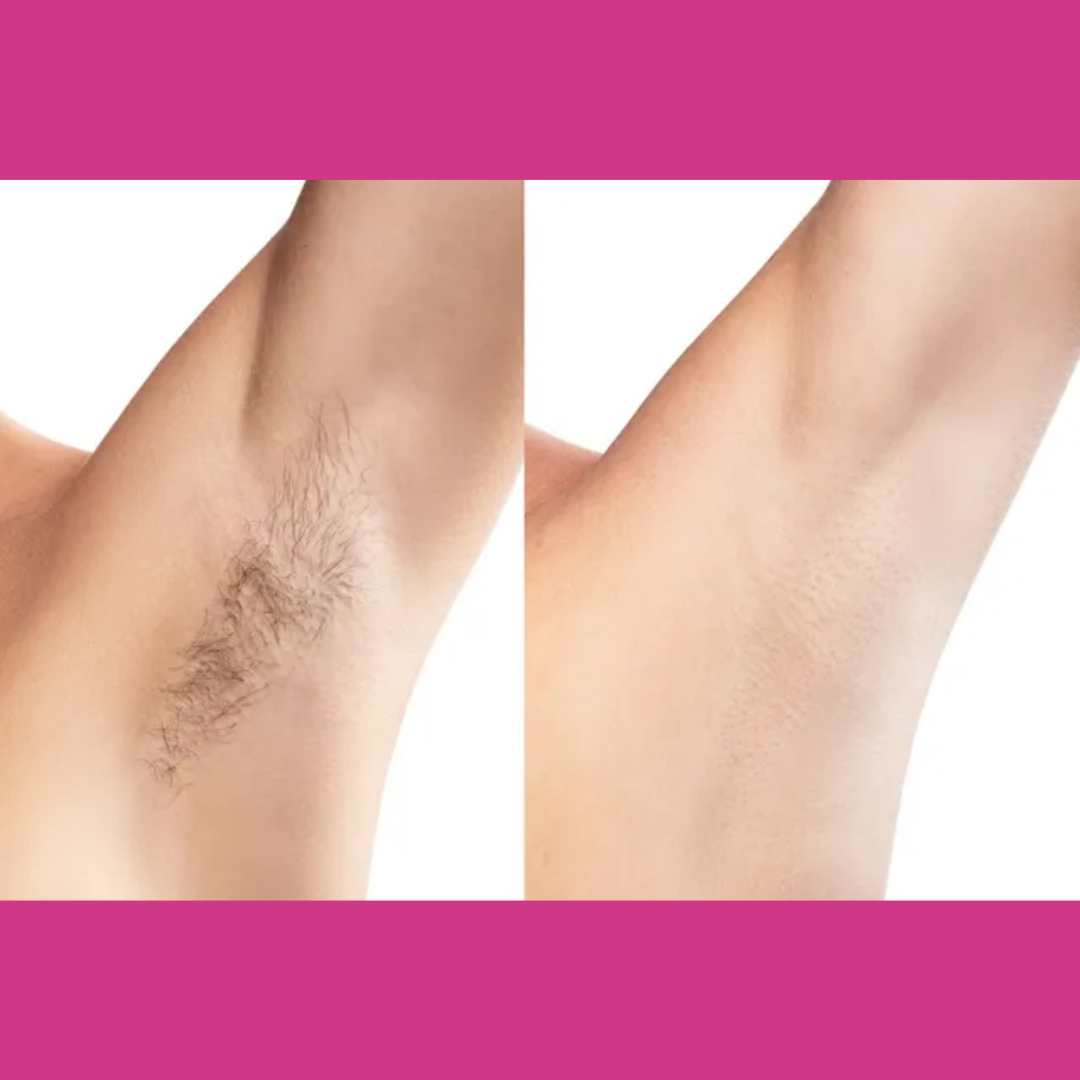 MEEOW 10-Min Painless DIY Hair Removal Mask | 4-in-1 Camel Milk & Rose Herbal Powder | Removes Hair, Reduces Tan, Exfoliates & Nourishes