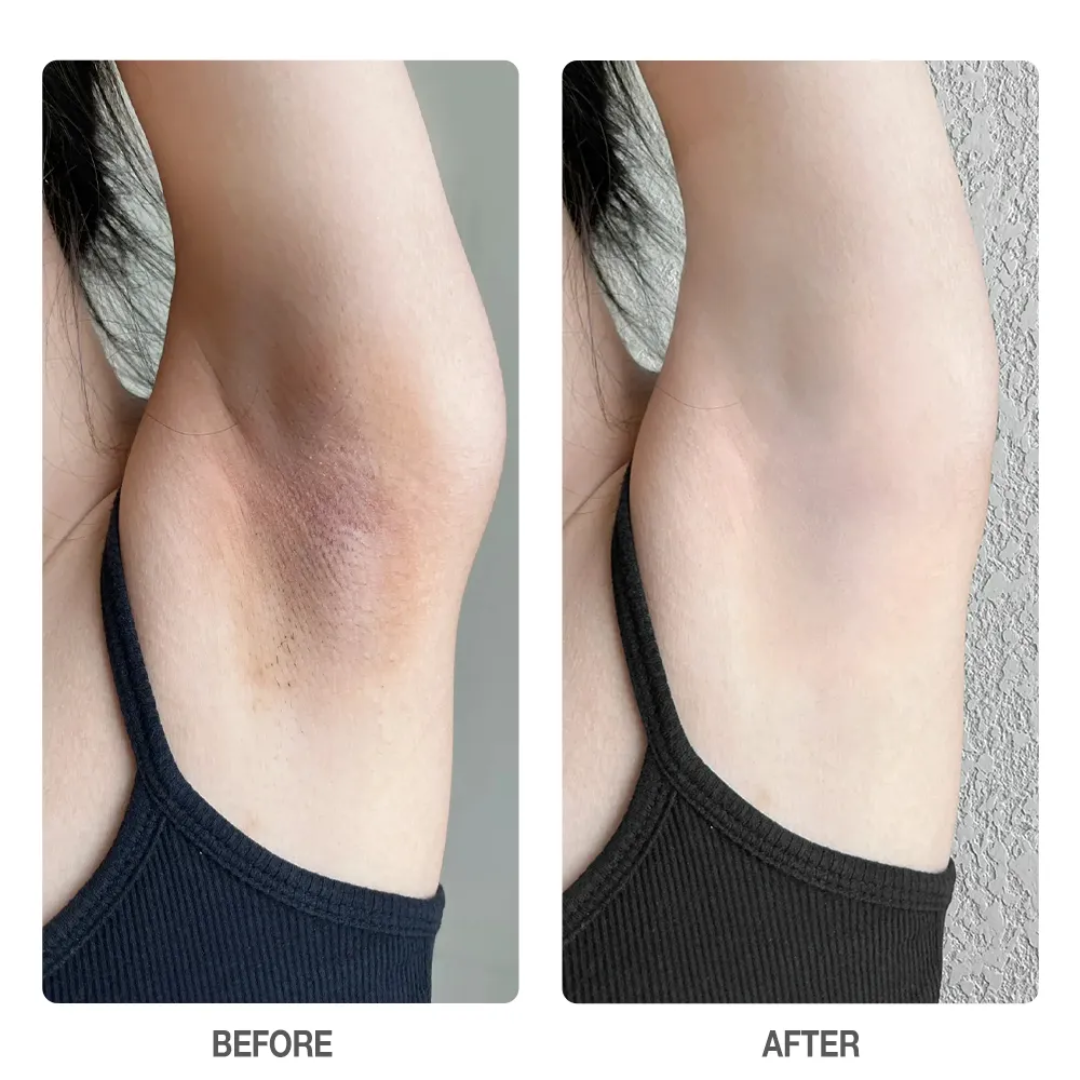 RAY BY RAFIA Underarm Serum – Time to Shine – Brightens Dark Underarms, Reduces Odour, Smooths Bumpy Skin – With Glycolic Acid – For Dark Neck & Strawberry Legs Too