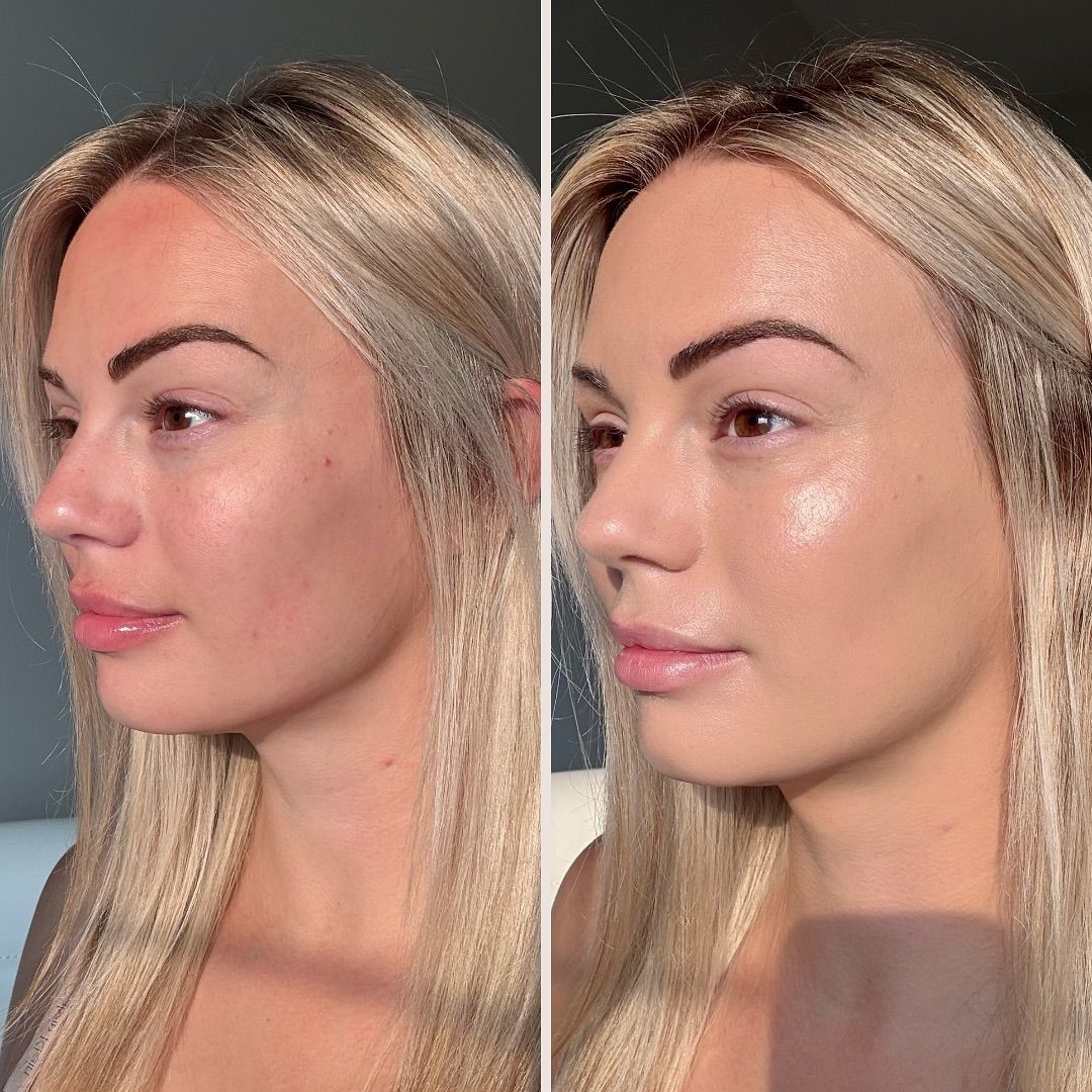 LAURA MERCIER Foundation Primer Radiance – Flawless Base, Radiant Finish – Instant Radiance, Smoothes & Blurs, Refines Pores & Fine Lines – Perfect Base All Day