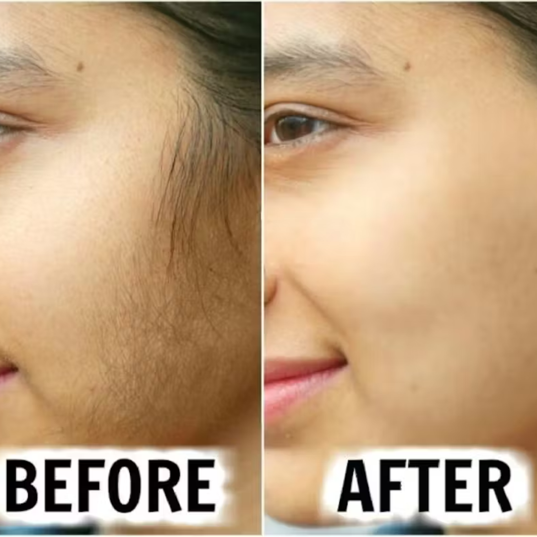 MEEOW 10-Min Painless DIY Hair Removal Mask | 4-in-1 Camel Milk & Rose Herbal Powder | Removes Hair, Reduces Tan, Exfoliates & Nourishes