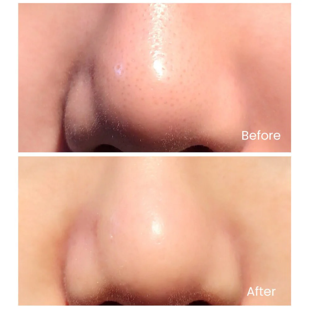 Deep Clean & Hydrating Trio Deal | include Makeup removing Wipes + Face Scrub + Clay mask | Clean & brighten Skin tone