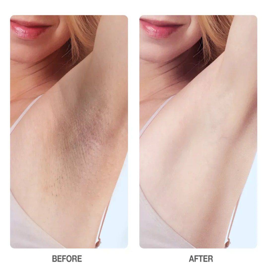 RAY BY RAFIA Underarm Serum – Time to Shine – Brightens Dark Underarms, Reduces Odour, Smooths Bumpy Skin – With Glycolic Acid – For Dark Neck & Strawberry Legs Too