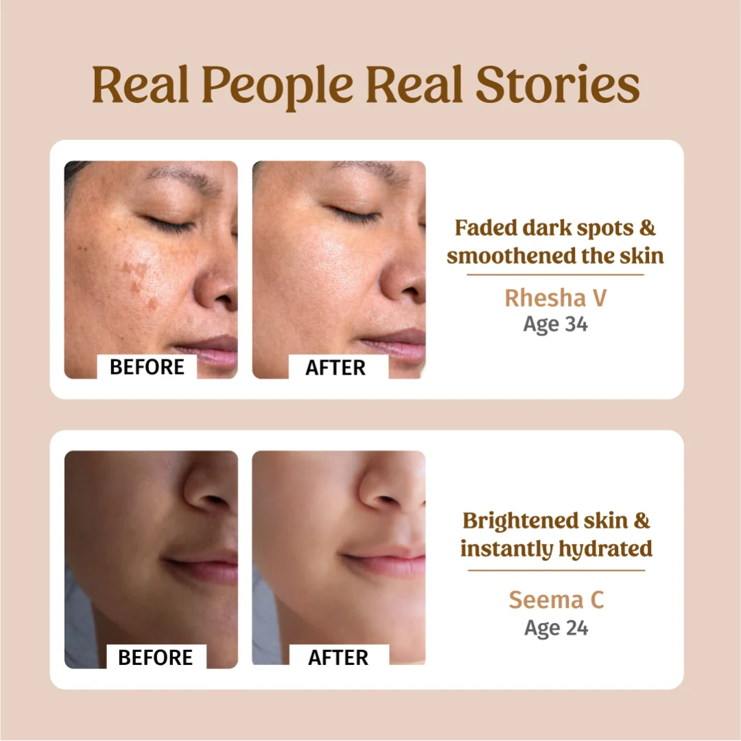 Simple Hydrating Light Moisturiser | 12-Hour Moisture, Vitamin B5+E & Niacinamide, for Sensitive Skin