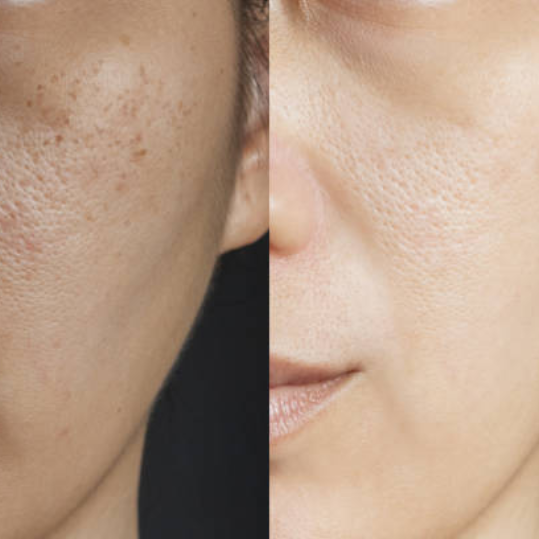 Deep Clean & Hydrating Trio Deal | include Makeup removing Wipes + Face Scrub + Clay mask | Clean & brighten Skin tone