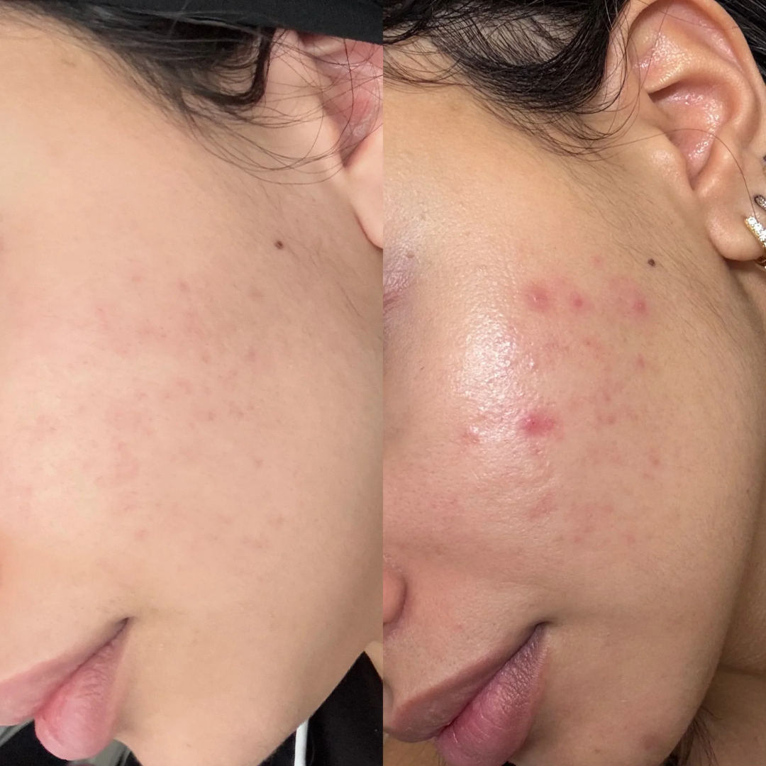 HYPHEN Double Shot Radiance-Lift Serum | Dual Phase Brightening + Collagen Booster | Reduces Fine Lines & Wrinkles