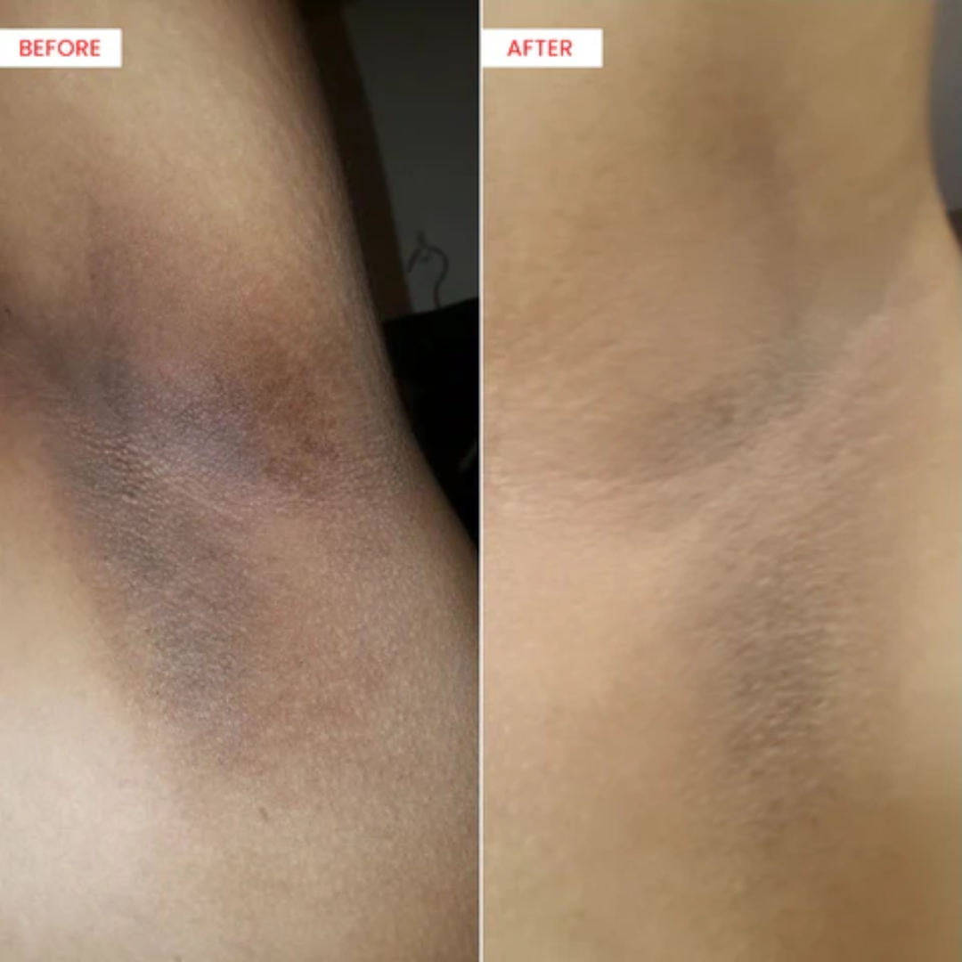 RAY BY RAFIA Underarm Serum – Time to Shine – Brightens Dark Underarms, Reduces Odour, Smooths Bumpy Skin – With Glycolic Acid – For Dark Neck & Strawberry Legs Too