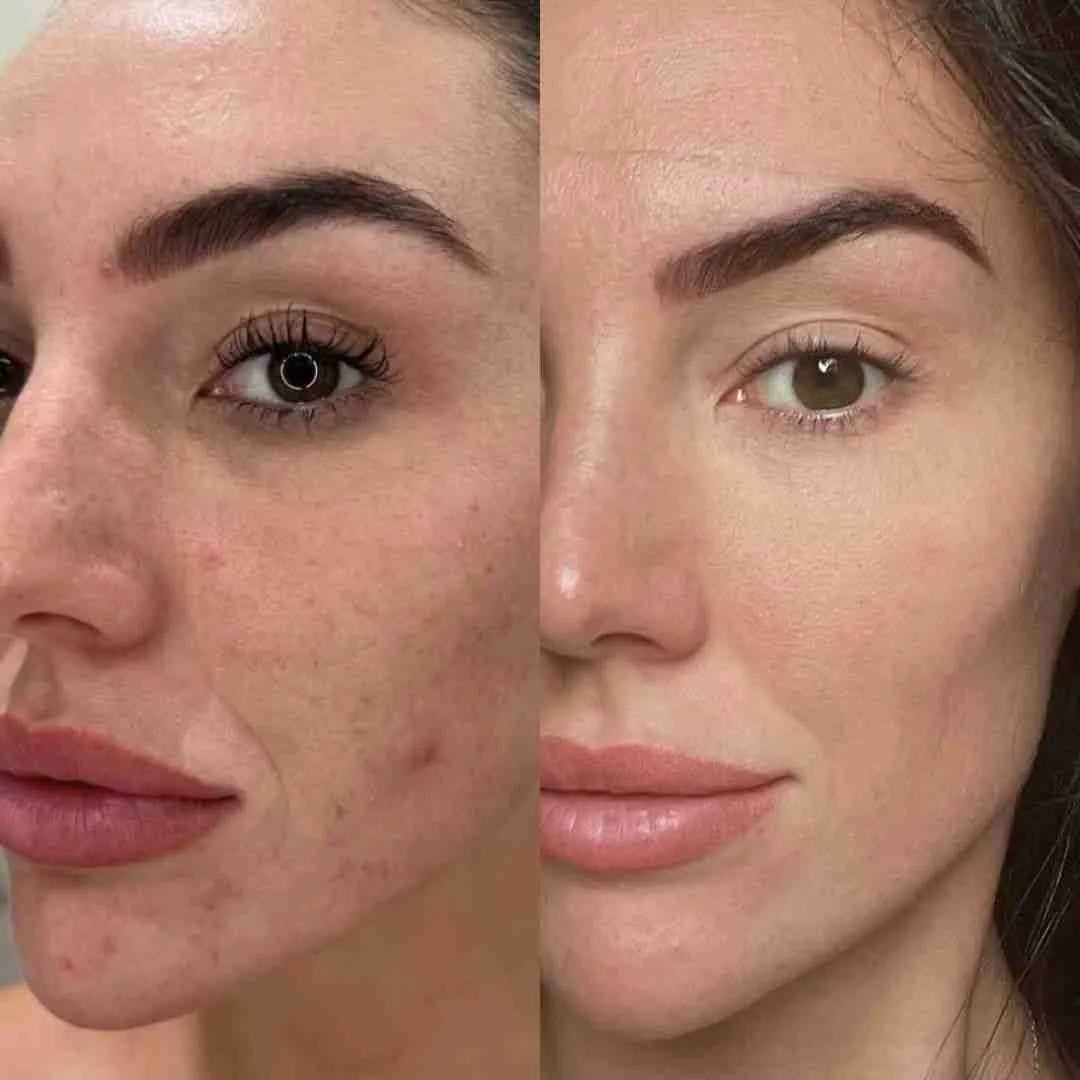 HYPHEN Double Shot Radiance-Lift Serum | Dual Phase Brightening + Collagen Booster | Reduces Fine Lines & Wrinkles