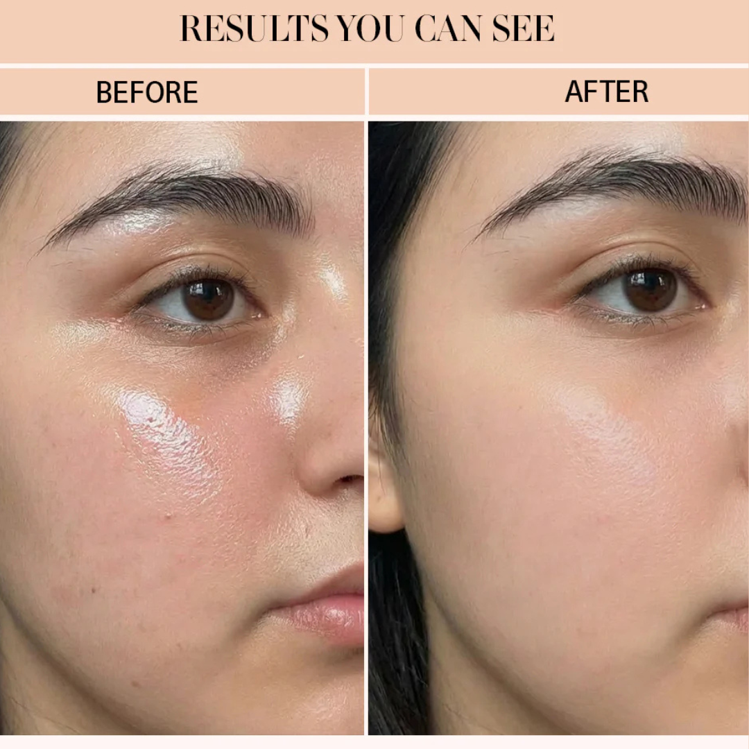 SL basics Natural Skin Tea | Balance Harmones &. Reduce Ance, pigmentation & bright complexion | Best for all Skin problems