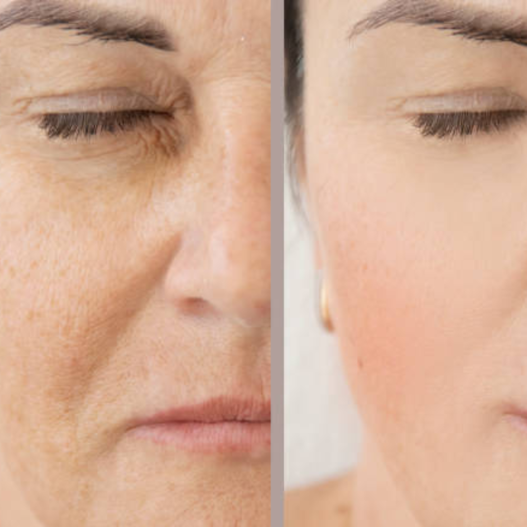 Madeca Cream Time Reverse | Blemish, Wrinkle & Dark Spot Repair | Imported from Korea