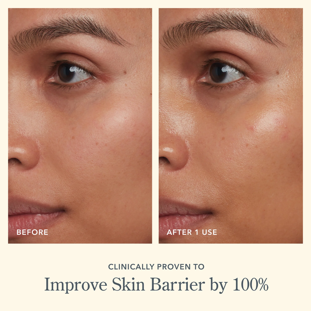 Simple Hydrating Light Moisturiser | 12-Hour Moisture, Vitamin B5+E & Niacinamide, for Sensitive Skin