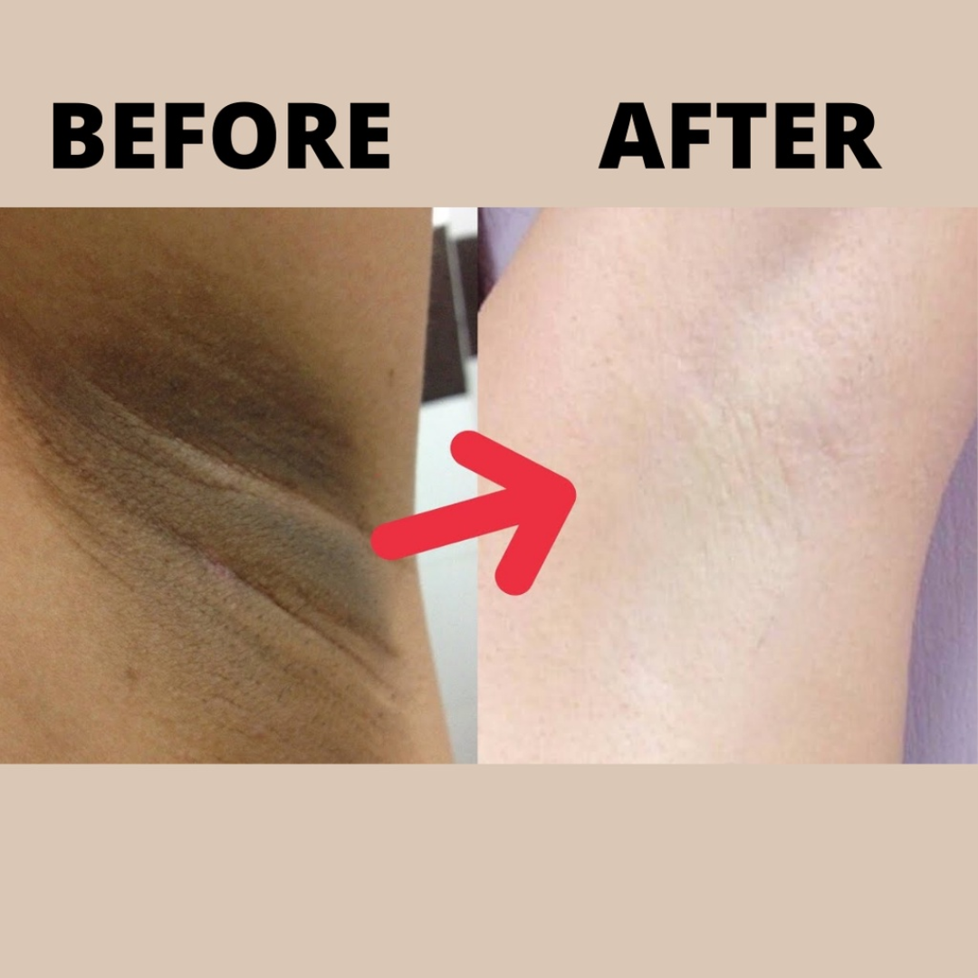 RAY BY RAFIA Underarm Serum – Time to Shine – Brightens Dark Underarms, Reduces Odour, Smooths Bumpy Skin – With Glycolic Acid – For Dark Neck & Strawberry Legs Too