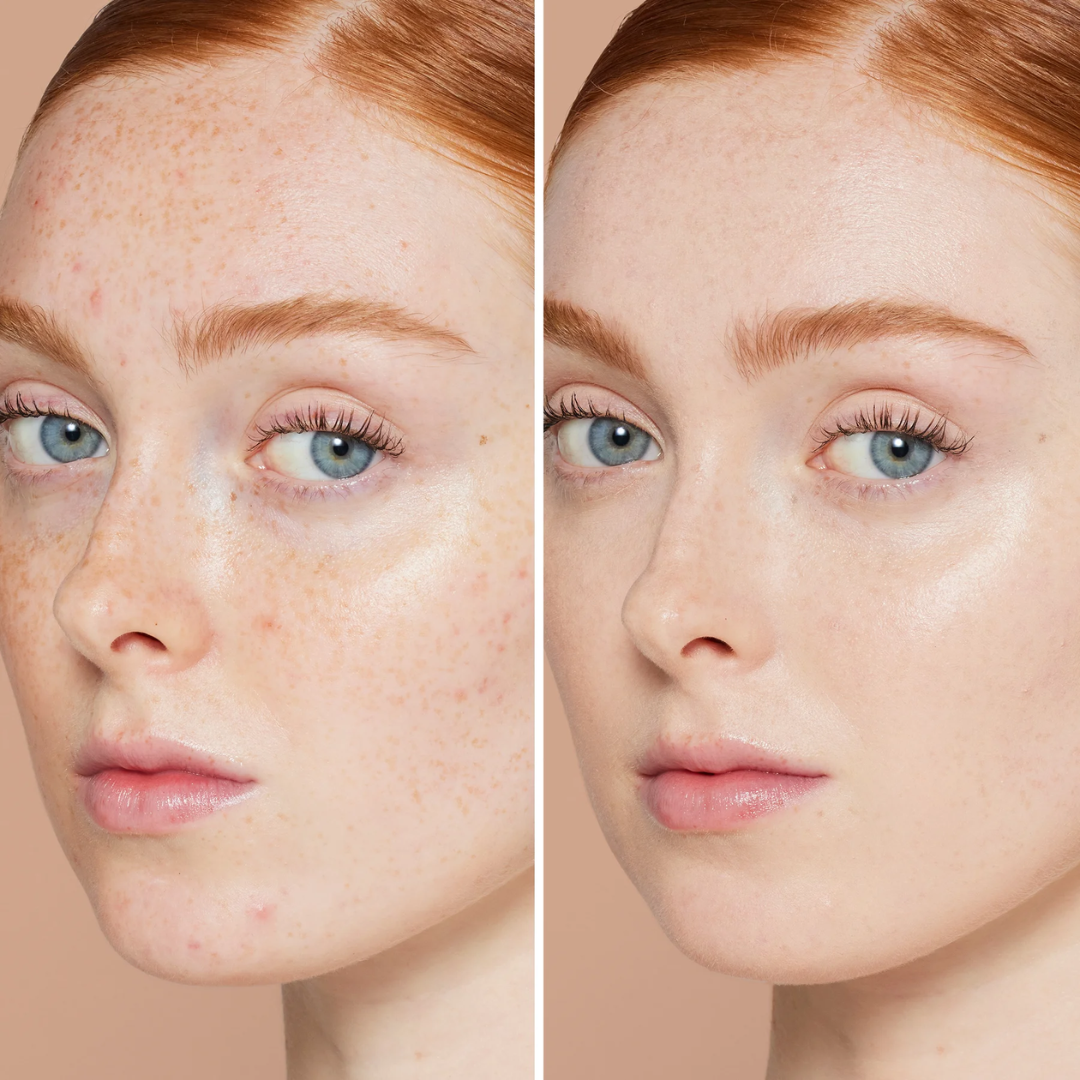 All in one High Coverage Tender Cream | Conceal, Cover & Hydration | Light weight & long-lasting | For all Skin Types