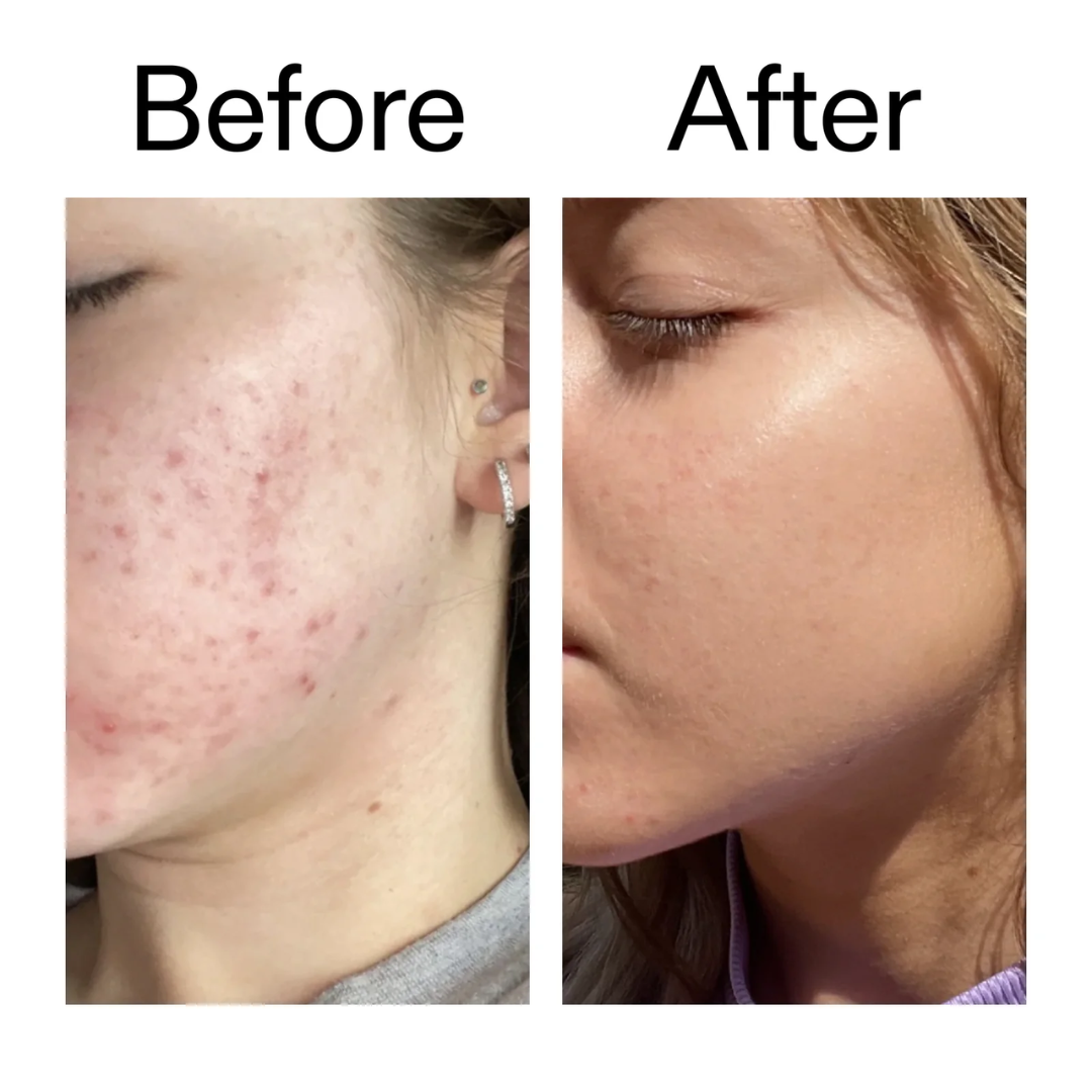 HYPHEN Double Shot Radiance-Lift Serum | Dual Phase Brightening + Collagen Booster | Reduces Fine Lines & Wrinkles