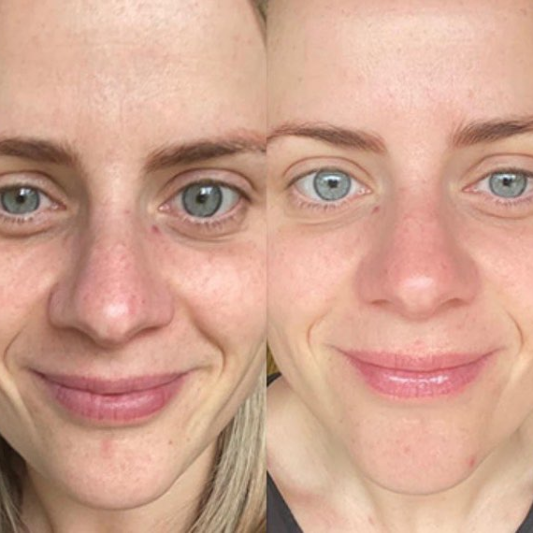Madeca Cream Time Reverse | Blemish, Wrinkle & Dark Spot Repair | Imported from Korea