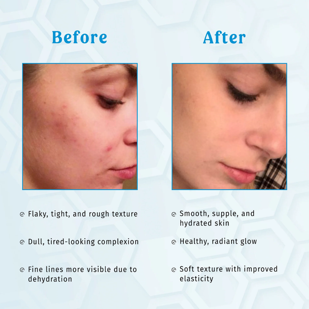 Simple Hydrating Light Moisturiser | 12-Hour Moisture, Vitamin B5+E & Niacinamide, for Sensitive Skin