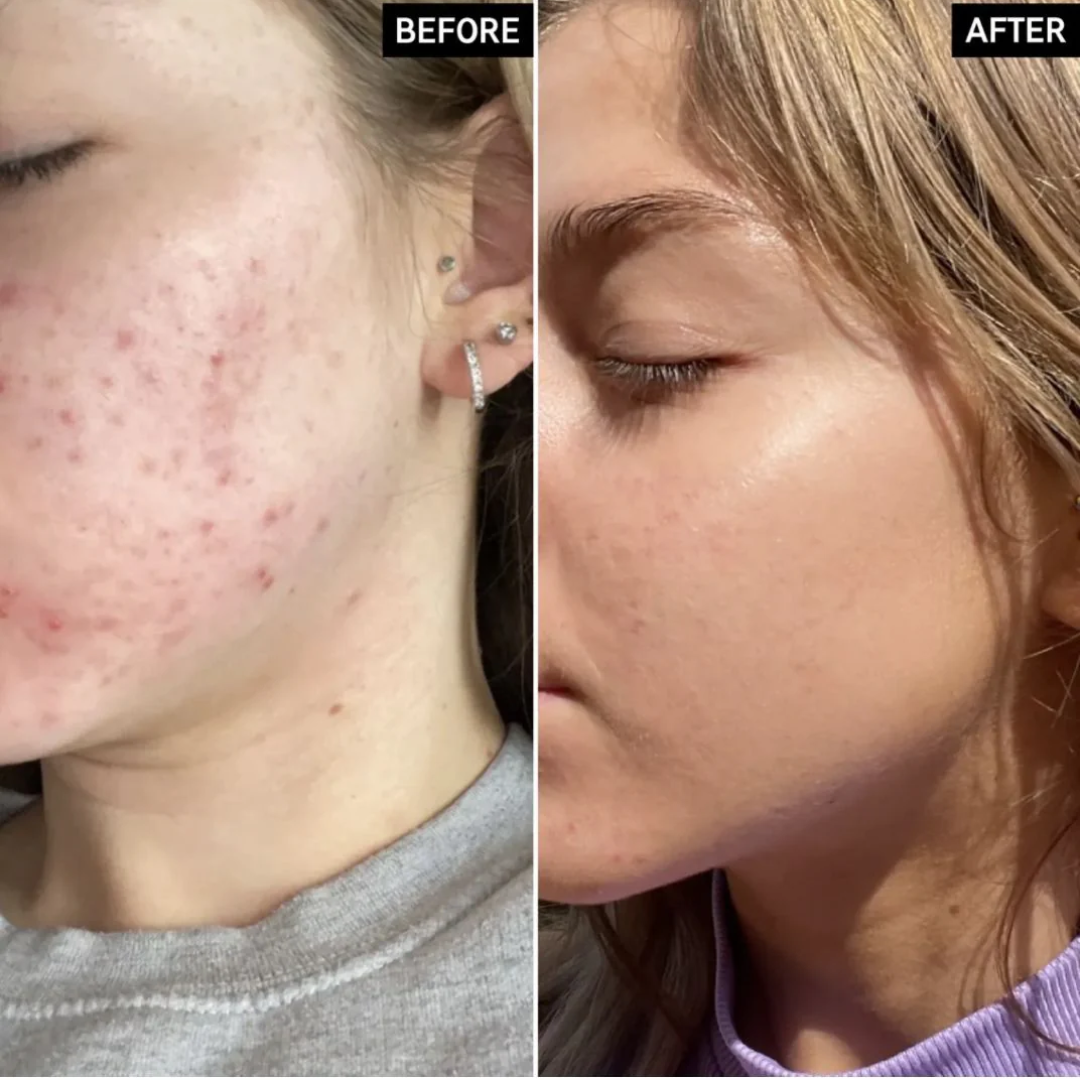 HYPHEN Double Shot Radiance-Lift Serum | Dual Phase Brightening + Collagen Booster | Reduces Fine Lines & Wrinkles