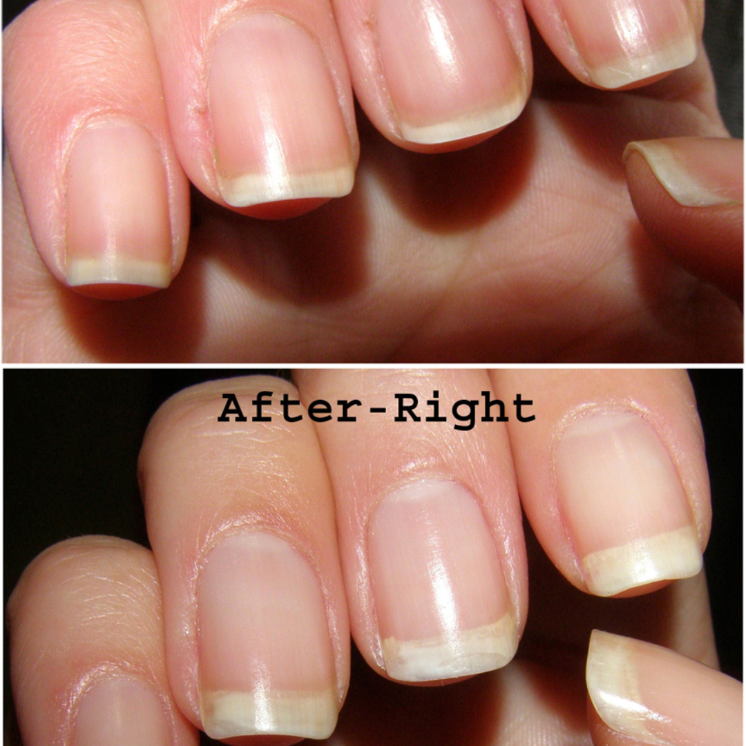 3 Days Nail Repair & Growth Serum – Keratin Amino Acid Formula – 50% OFF – Fast Strengthening & Hydrating – For Dry, Weak & Fragile Nails – Repairs Damage, Promotes Growth
