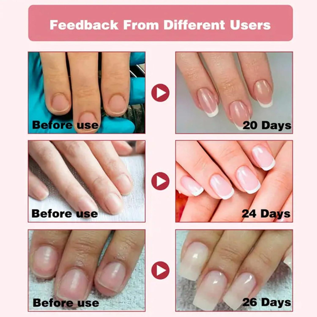3 Days Nail Repair & Growth Serum – Keratin Amino Acid Formula – 50% OFF – Fast Strengthening & Hydrating – For Dry, Weak & Fragile Nails – Repairs Damage, Promotes Growth