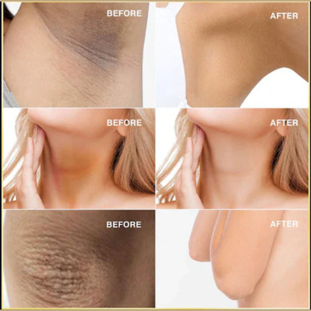 RAY BY RAFIA Underarm Serum – Time to Shine – Brightens Dark Underarms, Reduces Odour, Smooths Bumpy Skin – With Glycolic Acid – For Dark Neck & Strawberry Legs Too