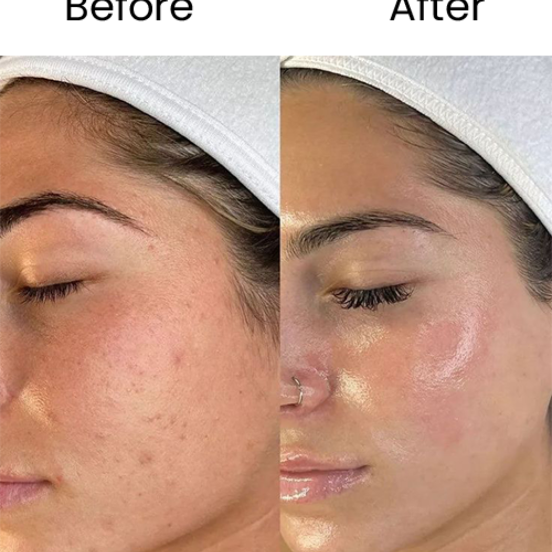 Aroma 7-Steps Magic Bridal Glow Facial Kit | Remove all impurities & blackheads in just single use | Bride like Glow at Home & Natural ingredients best for all Skin types
