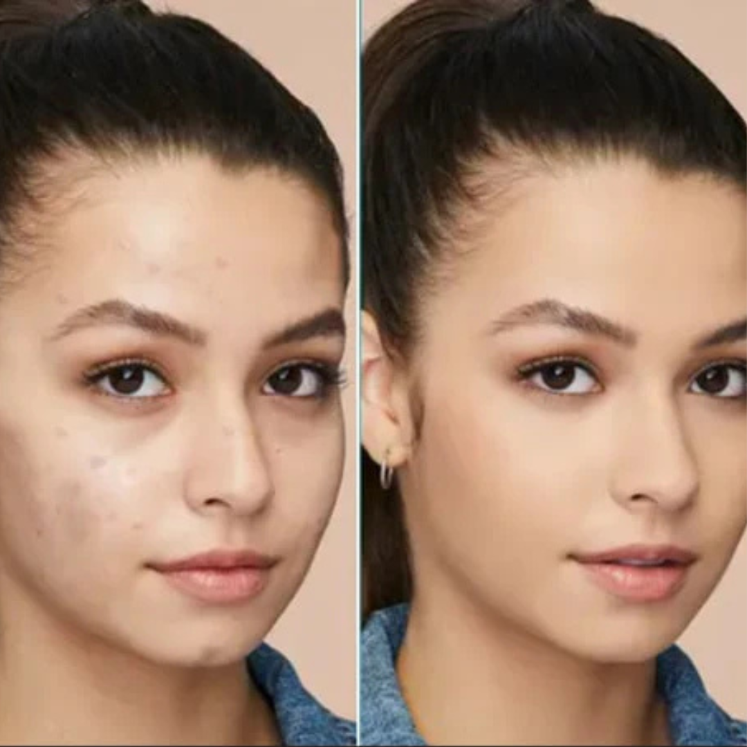 SL basics Sun & Glow Trio Deal | Sunblock + BB cream + Morich moisturizer | Flawless & Even Skin Tone
