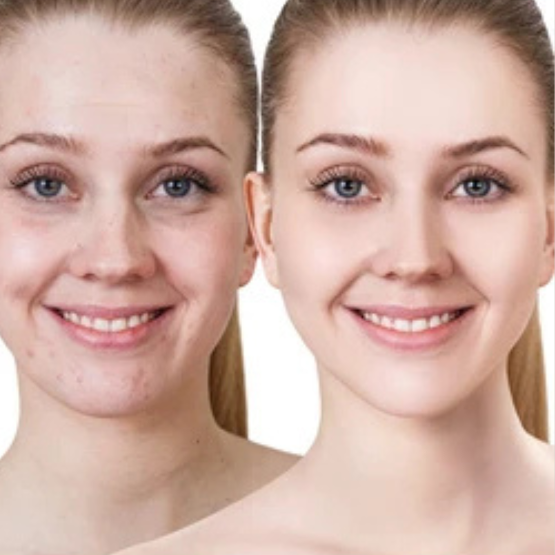 SL basics Sun & Glow Trio Deal | Sunblock + BB cream + Morich moisturizer | Flawless & Even Skin Tone
