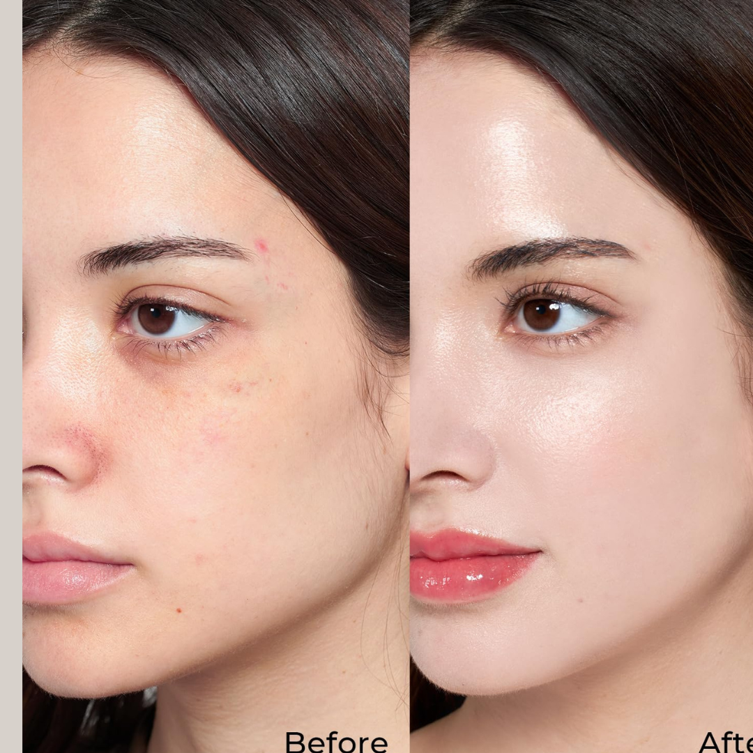SL basics Sun & Glow Trio Deal | Sunblock + BB cream + Morich moisturizer | Flawless & Even Skin Tone