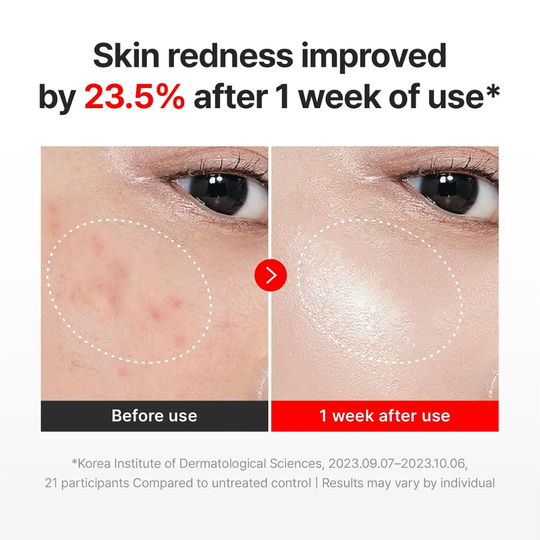 Time Reverse Madeca Cream | Anti-Aging & Skin Revitalization | Pharmaceutical-Grade TECA