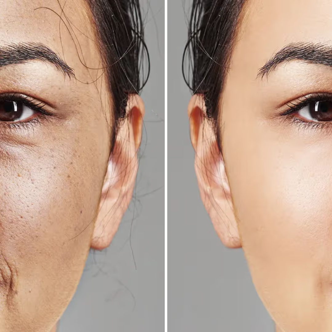 Time Reverse Madeca Cream | Anti-Aging & Skin Revitalization | Pharmaceutical-Grade TECA