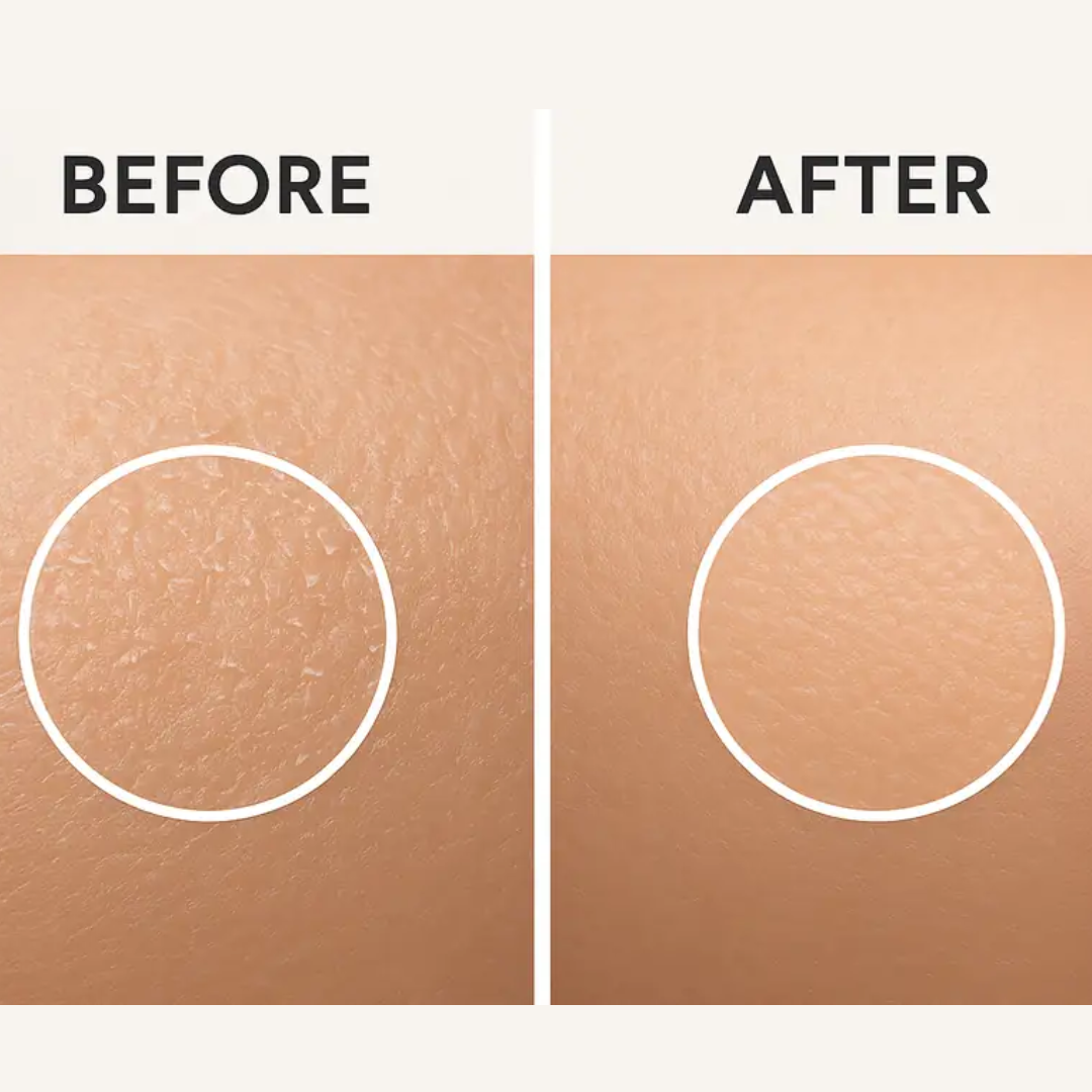 Simple Hydrating Light Moisturiser | 12-Hour Moisture, Vitamin B5+E & Niacinamide, for Sensitive Skin