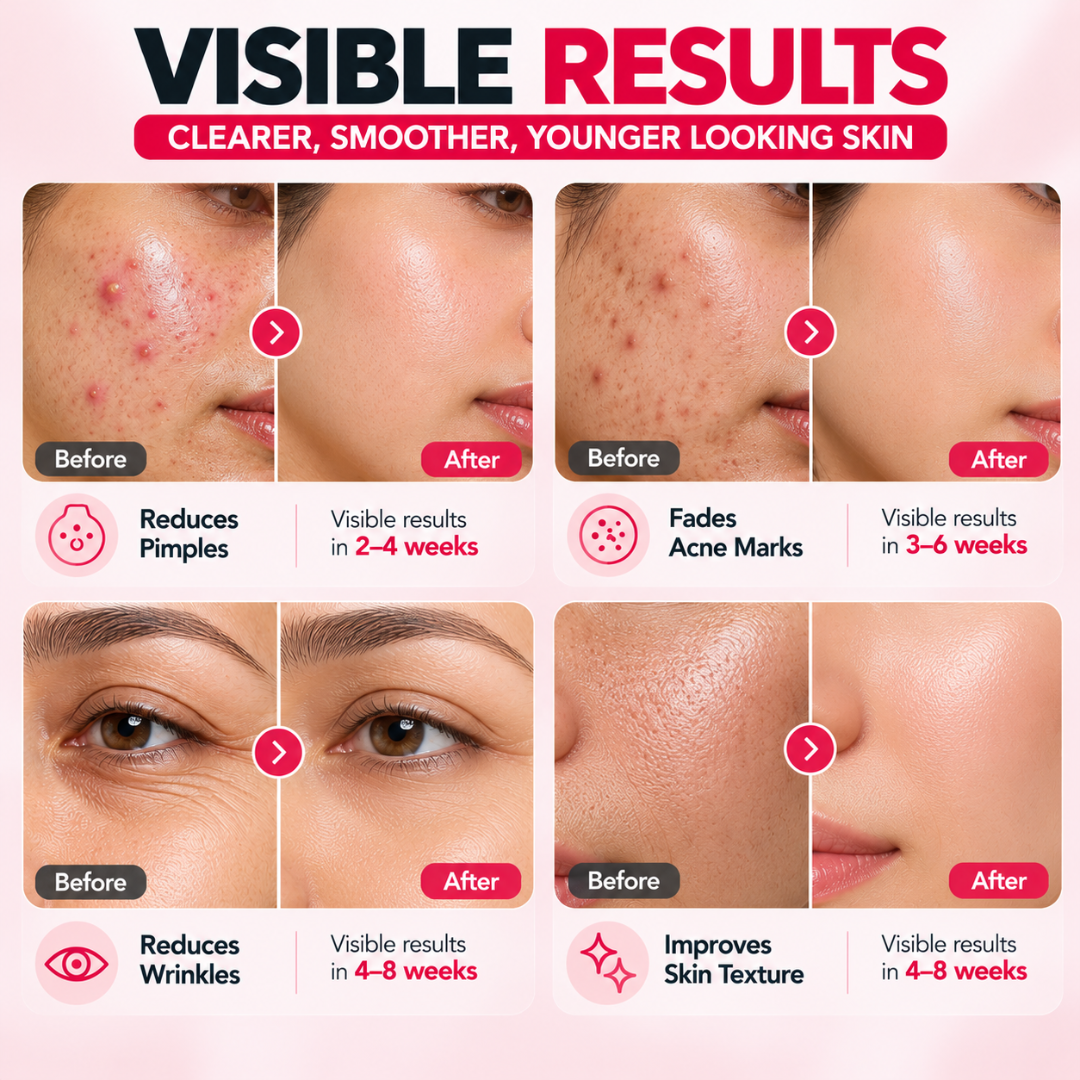 DermaFuture Precision Vitamin A Serum – Revitalizing Therapy for Acne Control, Wrinkle Reduction & Collagen Boost, High Potency Formula for Clear Skin