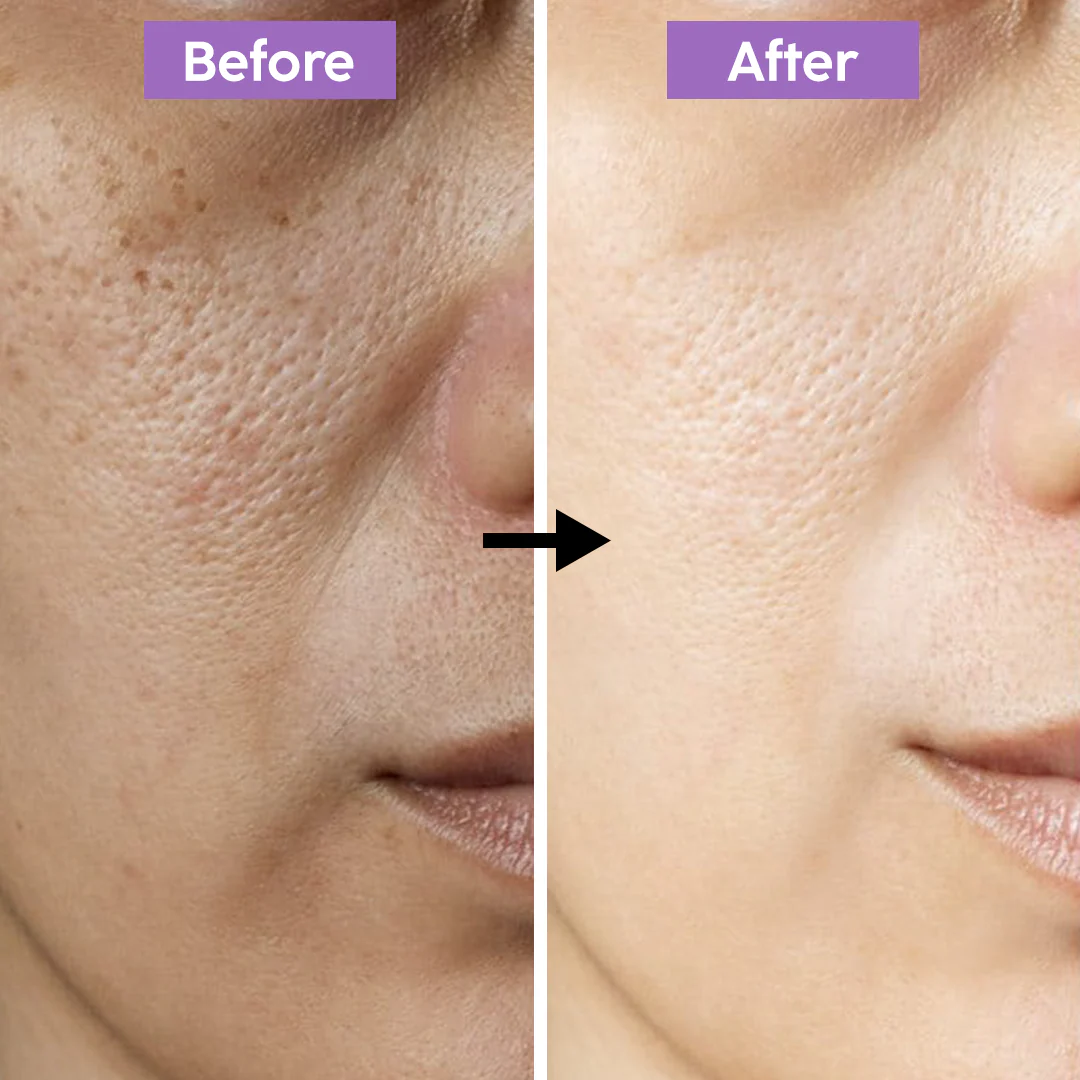 Madeca Cream Time Reverse | Blemish, Wrinkle & Dark Spot Repair | Imported from Korea